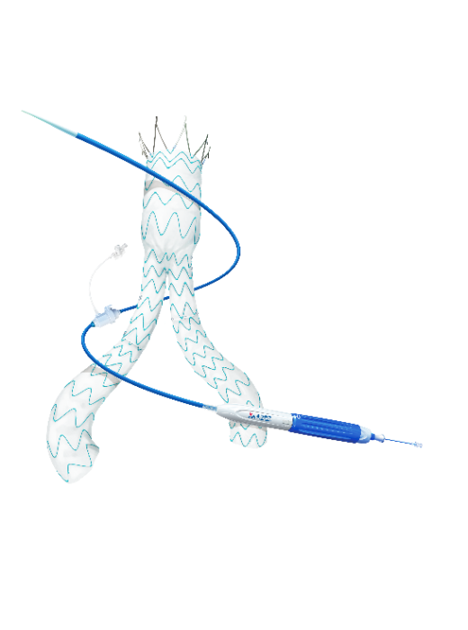 Minos?腹主動脈覆膜支架及輸送系統(tǒng)-1