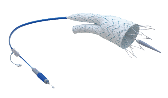 Minos?腹主動脈覆膜支架及輸送系統(tǒng)-2