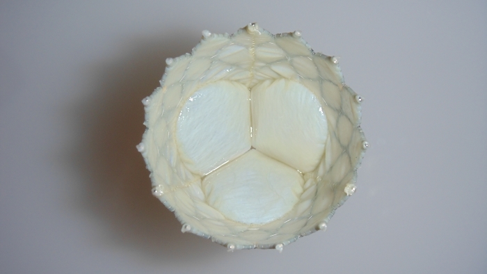 主動(dòng)脈瓣膜-4