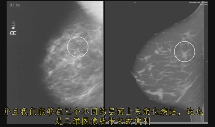 KBCT產(chǎn)品優(yōu)勢3