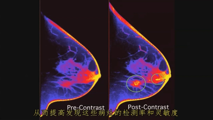 KBCT產(chǎn)品優(yōu)勢5