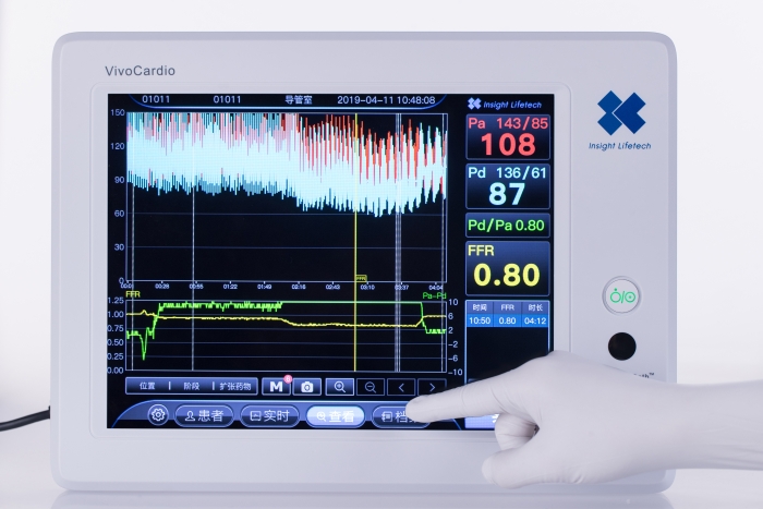 血流儲(chǔ)備分?jǐn)?shù)測(cè)量設(shè)備圖片