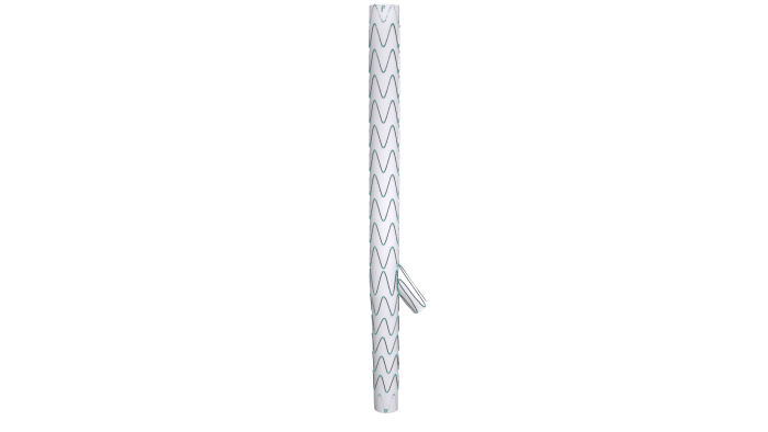 照片1-先健科技-髂動脈分叉支架